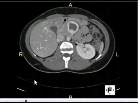 Ct scan abdomen anatomy pdf